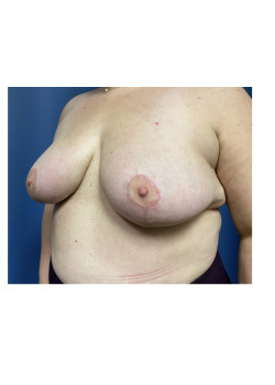 After Image