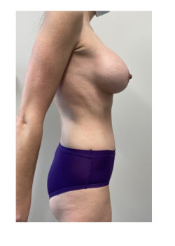 After Image