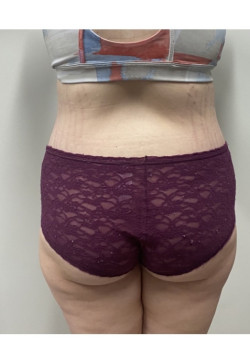 After Image
