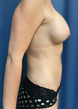 After Image