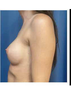 After Image