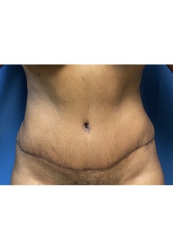 After Image