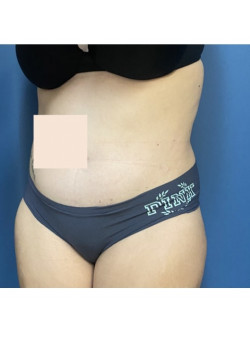 After Image