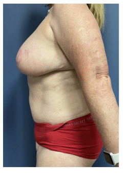 After Image