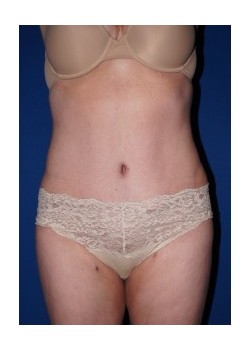 After Image