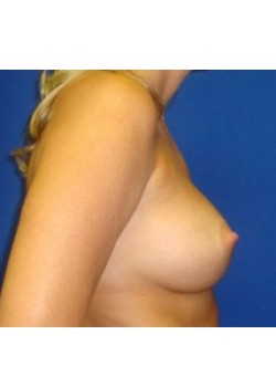 After Image