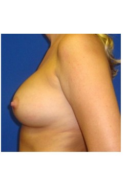 After Image