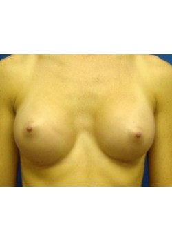 After Image