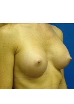 After Image