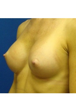 After Image