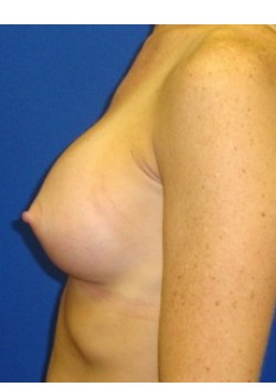 After Image